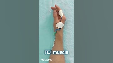 Alternative placements for TetraSens