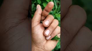 I Have A Insects My Hand