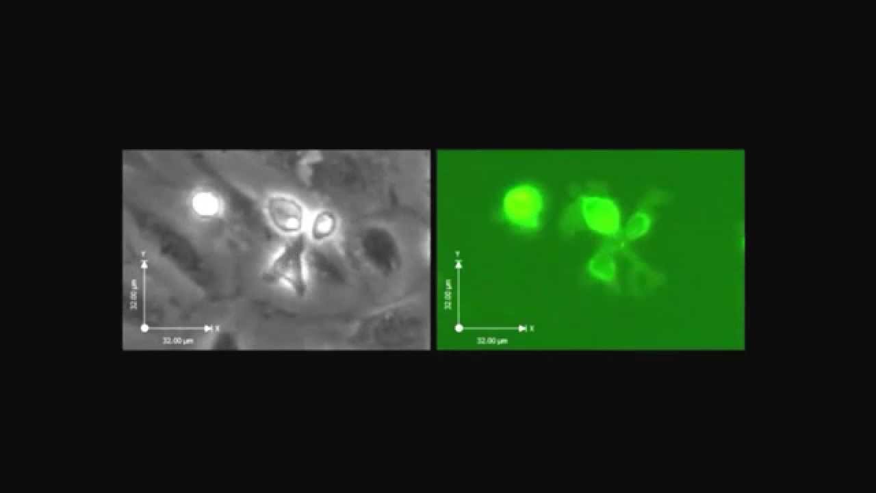 PNAS : L-selectin shedding is activated specifically within transmigrating pseudopods...