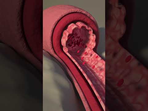 What Happens During Orgasm