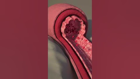 What happens during orgasm