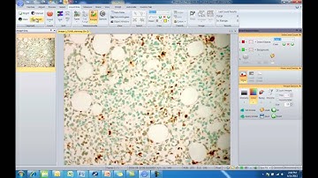 Features Overview Video for Image-Pro Premier Software