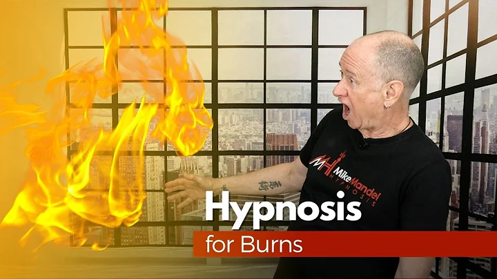 Hypnosis for Burns
