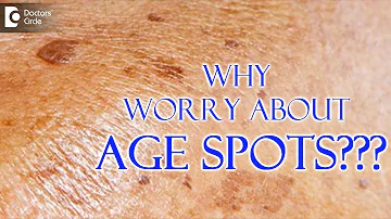 Can age spots be red?