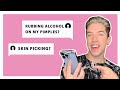 ACNE | Answering Your Most Asked Questions!