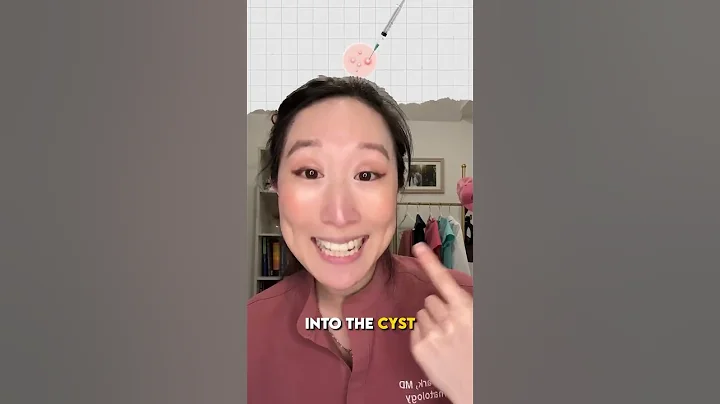 How to make an #acnecyst vanish in 24 hours! This is a great treatment for one off cysts