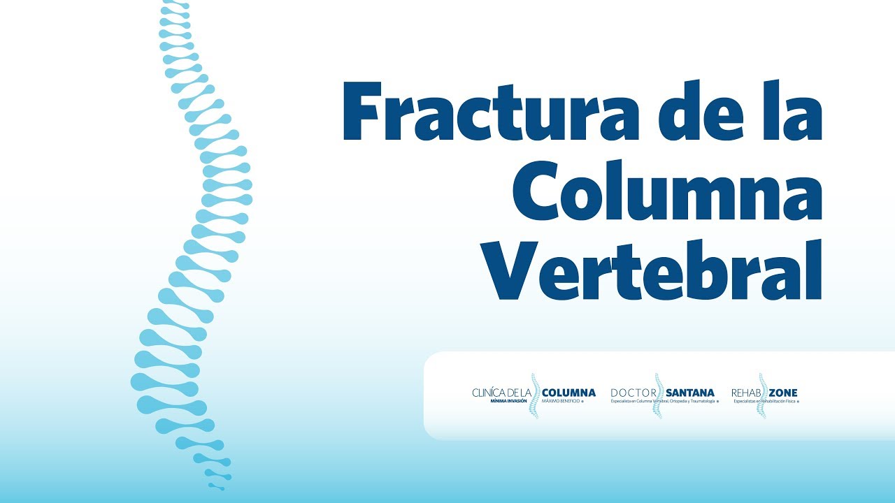tampa Clínica de la Columna - Fractura de la Columna Vertebral - Dr. Santana