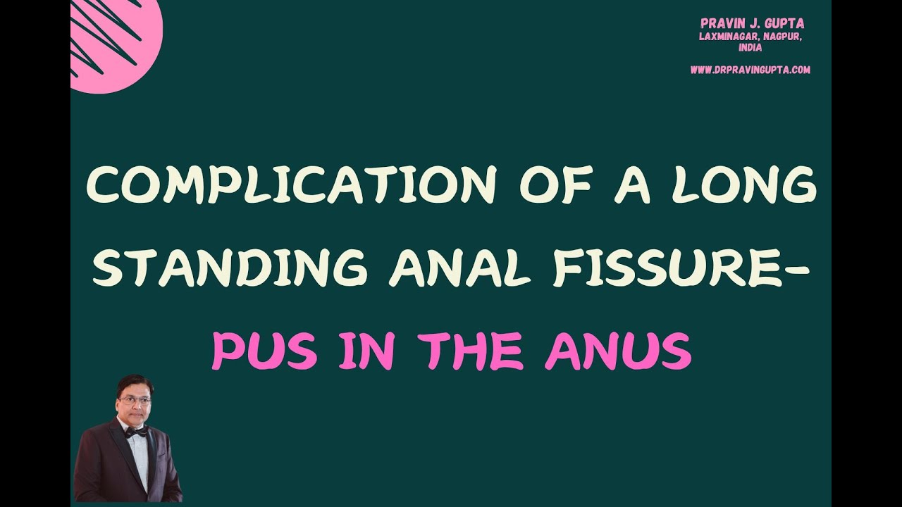 Complication Of A Long Standing Anal Fissure Pus In The Anus Youtube 