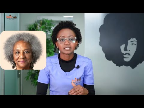 Hair loss and age