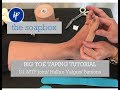 the SOAPBOX- Ep.14- Big Toe/ D1 MTP Joint Taping (Hallux Valgus/ Bunions)