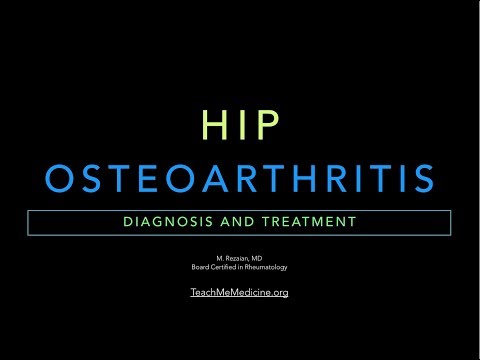 What Grade 4 Osteoarthritis Hip