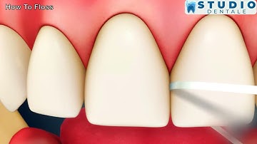 Mastering the Art of Flossing: Your Guide to a Healthy Smile! | We Care Health Center PVT. LTD.