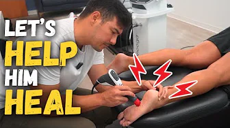 His Feet HURT! Treatment & Exercise for PLANTAR FASCIITIS || Chiropractic Treatment with Dr. Tyler