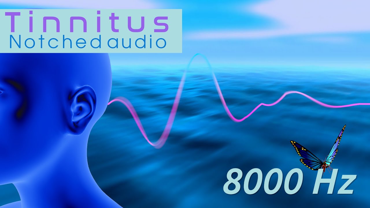 Tinnitus Sound Therapy - 8000 Hz Notched Edition - Ocean Wave Soundscape