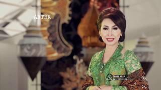 Download lagu BeforeAfter 2011-2015