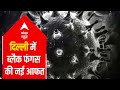 Black fungus infection spreads to small intestine in Delhi patients