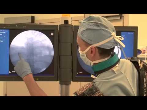 Phrenic Nerve Injury Treatment | UCLA Plastic and Reconstructive Surgery
