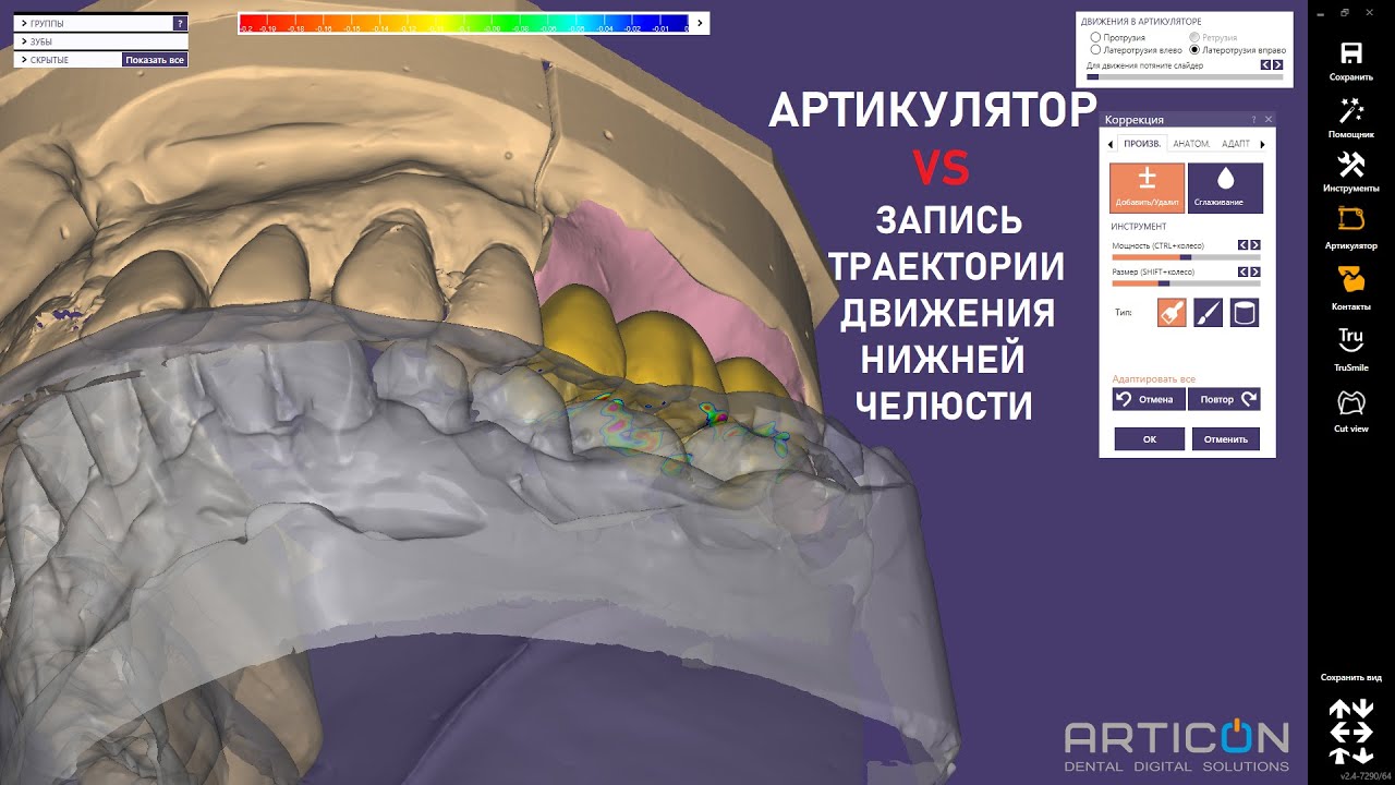 Окклюдатор и артикулятор презентация