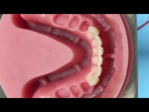 Full digital denture