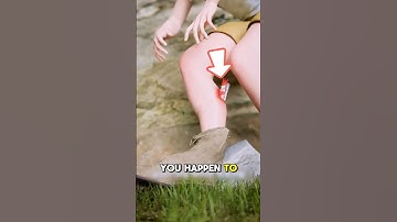 How to Treat a Broken Leg in Seconds!