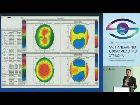 Corneal cross linking