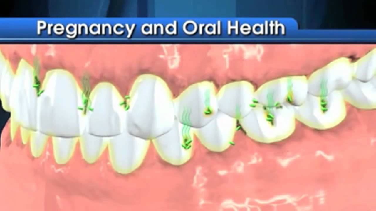 Dental Care During Your Pregnancy 