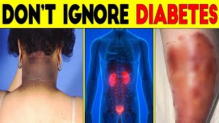 7 Diabetes Nighttime Signs You Will Regret Ignoring | amazing health