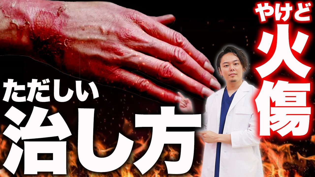 熱傷の治療:最近の進歩 医学書 やけど 熱傷 救急科 形成外科 皮膚科 裁断なし 56312-724x1024.jpg