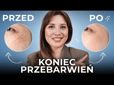 Co na PRZEBARWIENIA