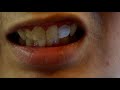 Fix a MISSING or BROKEN TOOTH AT HOME