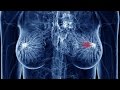 【衝撃】ガン細胞を短時間に98%死滅する驚異の食べ物に世界が震えた!【健康雑学】