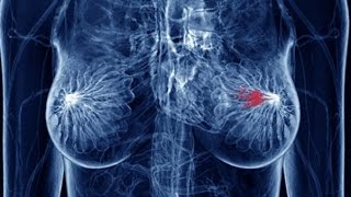 【衝撃】ガン細胞を短時間に98％死滅する驚異の食べ物に世界が震えた!【健康雑学】