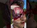 He Survived An Arrow Through His Skull 😵