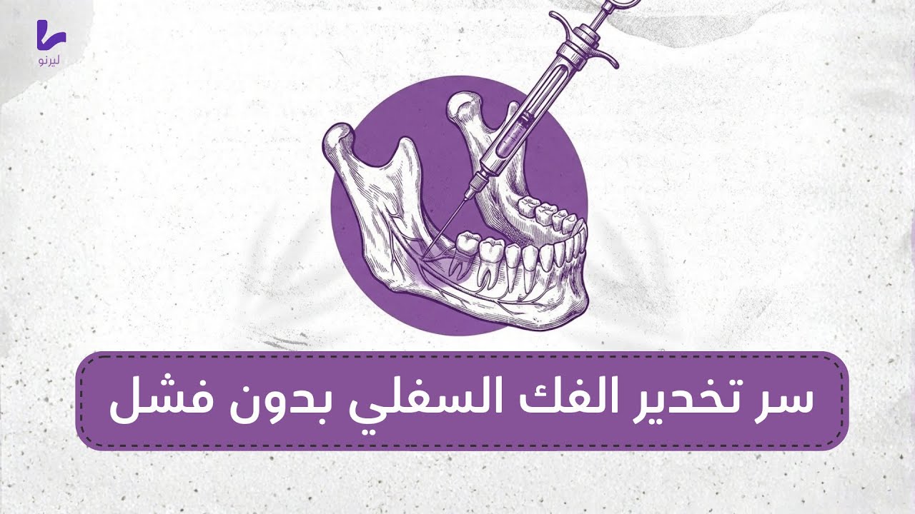 بروتكول - INBA ببساطة | سر تخدير الفك السفلي بدون فشل في طب الاسنان (أهم تخدير في عيادة الأسنان)