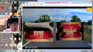20141013 박진현 총의치기공학 실습 4주차 인공치 배열