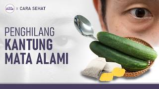 Cara Menghilangkan Kantung Mata dengan Bahan Alami | Hidup Sehat tvOne