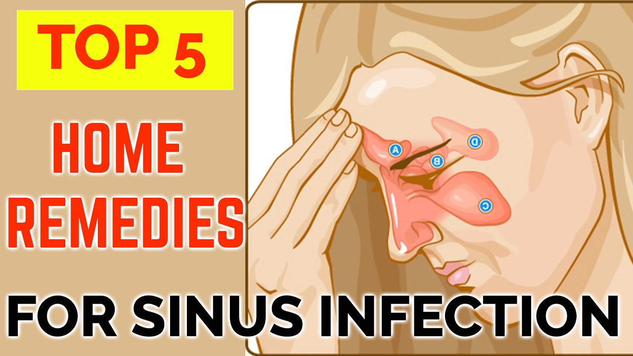 feline sinus infection home remedy
