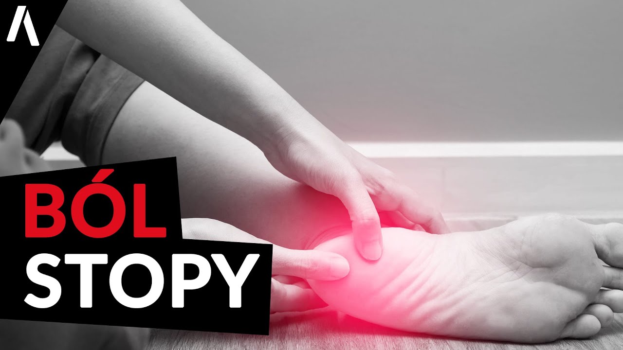 Zapalenie Rozcięgna Podeszwowego I Ból w stopie I Jak się go pozbyć?