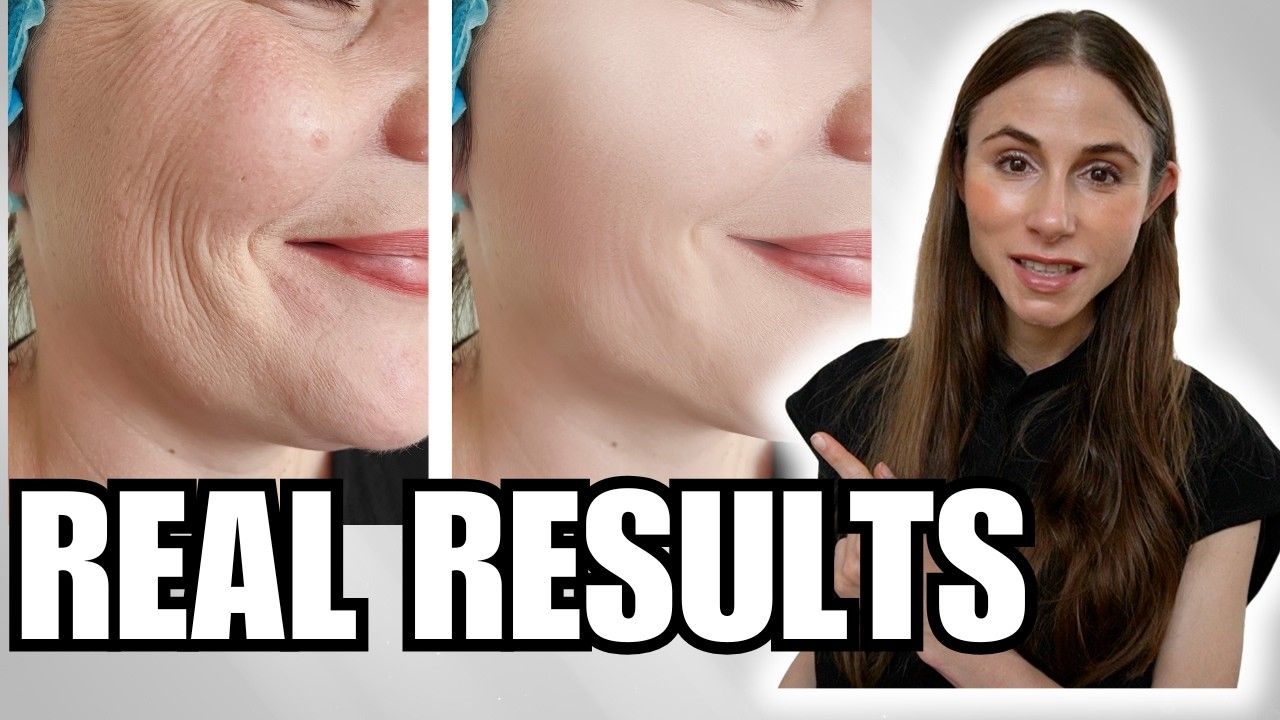 Sculptra, CO2 Laser,  Red Light Therapy: What Really Improves Skin Aging?