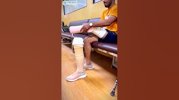 Price of Artificial Leg in India | 20,000 | Padeline Liner | Credence Prosthetic India | #ossurindia