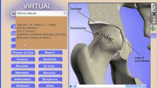 Virtual Consultation 3D ROF Software
