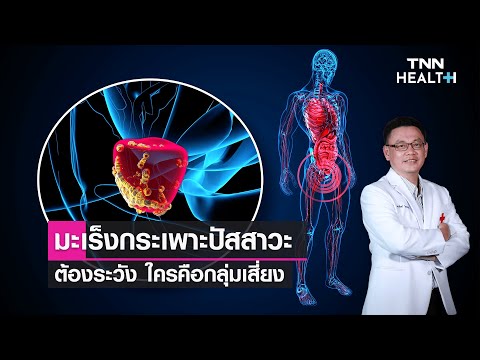 มะเร็งกระเพาะปัสสาวะ ต้องระวังใครคือกลุ่มเสี่ยง? : Daily Health