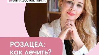 РОЗАЦЕА - как лечить (запись вебинара от 05.2024)