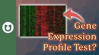 Insights into Your Myeloma: Gene Expression Profile (GEP) Test