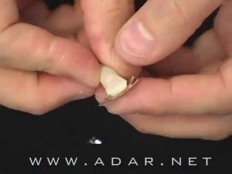 How to Master Porcelain Laminate Veneers with Platinum Foil Technique