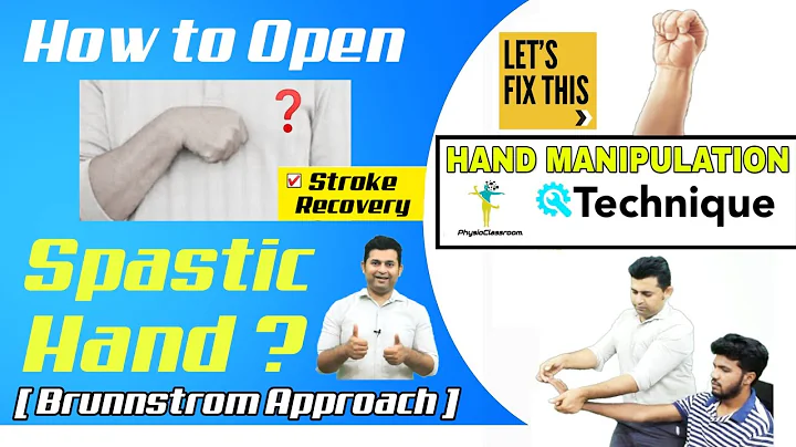 HAND MANIPULATION TECHNIQUE TO FACILITATE FINGER EXTENSION(RELEASING) IN STROKE/HEMIPLEGIA PATIENTS. - DayDayNews