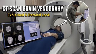 CTV Brain Protocol | How to Perform Brain Venography Scan