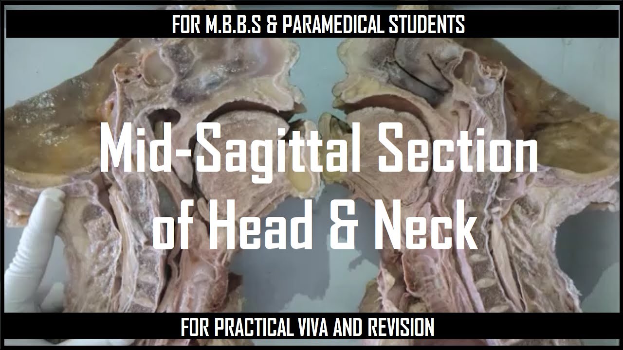 Mid-sagittal section of Head and Neck || only for exam revision 