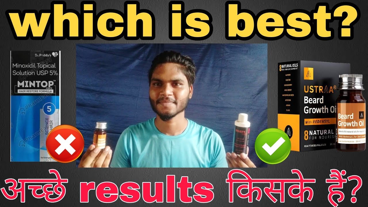 Minoxidil vs beard oilWhich is best minoxidil 5 or ustraa beard