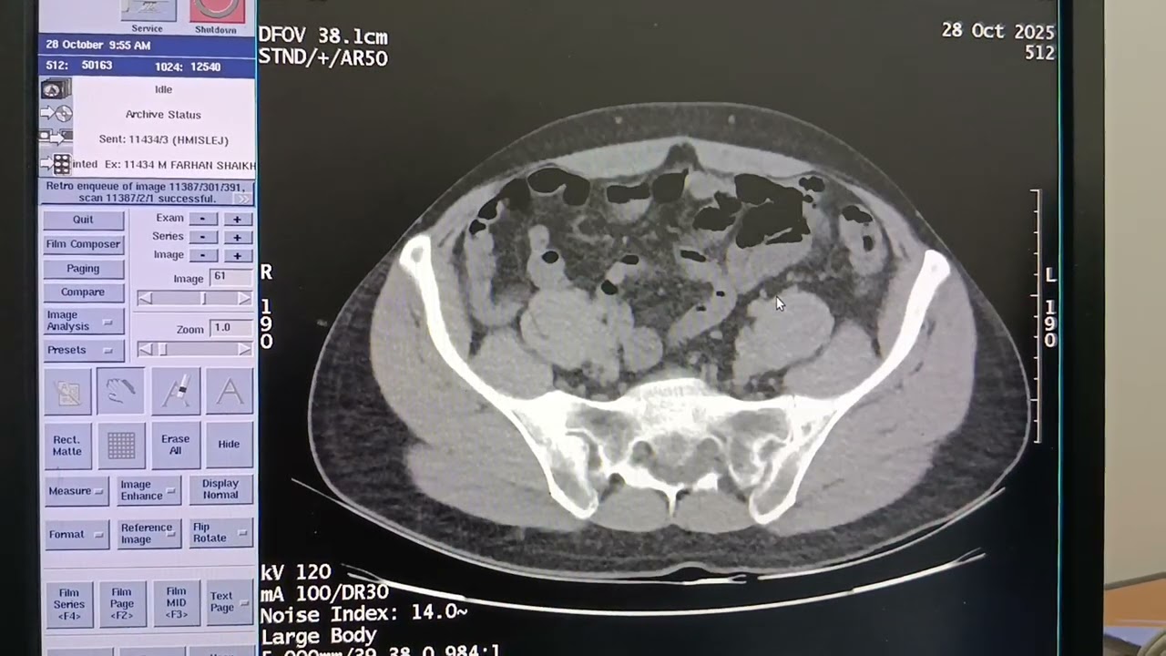 CT INSTA kub l COMPLETE DETAILS I 